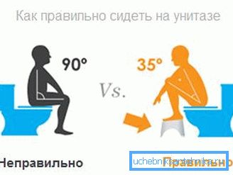 На фота - становішча чалавека на ўнітазе пры дэфекацыі На фота - становішча чалавека на ўнітазе пры дэфекацыі